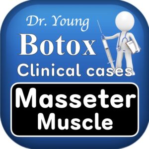 보톡스 임상케이스 Botox Clinical cases - Masseter muscle