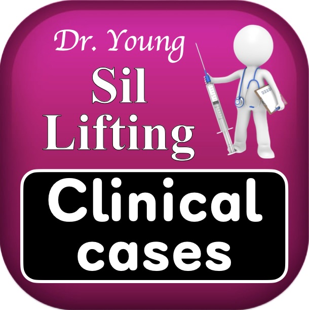 실리프팅 Clinical cases